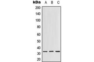 Western blot analysis of RPS3 expression in Jurkat (A), mouse liver (B), rat lung (C) whole cell lysates. (RPS3 anticorps  (C-Term))