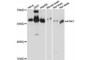 Western blot analysis of extracts of various cell lines, using IP6K1 antibody (ABIN6293094) at 1:1000 dilution. (IP6K1 anticorps)
