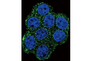 Immunofluorescence (IF) image for anti-Succinate Dehydrogenase Complex, Subunit D, Integral Membrane Protein (SDHD) antibody (ABIN2996554)