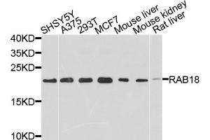 Western blot analysis of extracts of various cell lines, using RAB18 antibody (ABIN5971481) at 1/1000 dilution. (RAB18 anticorps)
