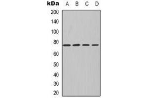 Western blot analysis of PKC iota/zeta expression in MCF7 (A), NIH3T3 (B), mouse kidney (C), rat kidney (D) whole cell lysates. (PKC iota/zeta anticorps)