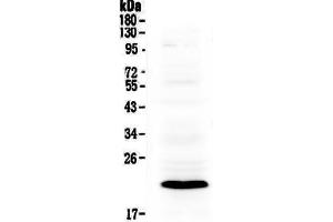 Western blot analysis of Bcl-2 using anti-Bcl-2 antibody .