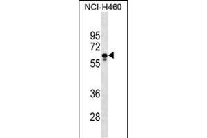 PGS1 Antibody (Center) (ABIN1538219 and ABIN2849280) western blot analysis in NCI- cell line lysates (35 μg/lane). (PGS1 anticorps  (AA 272-299))