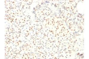 Formalin-fixed, paraffin-embedded human Pancreas stained with LMO2 Mouse Monoclonal Antibody (LMO2/1971).