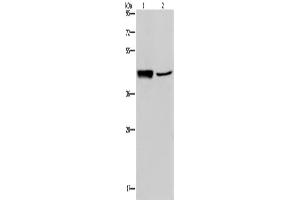 Western Blotting (WB) image for anti-Gastrin-Releasing Peptide Receptor (GRPR) antibody (ABIN2425927) (GRPR anticorps)