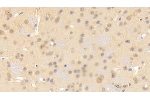 Detection of CNTN3 in Mouse Cerebrum Tissue using Polyclonal Antibody to Contactin 3 (CNTN3)