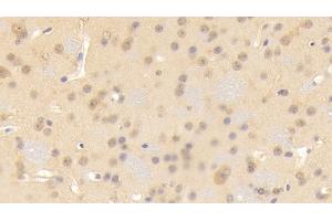 Detection of CNTN3 in Mouse Cerebrum Tissue using Polyclonal Antibody to Contactin 3 (CNTN3) (CNTN3 anticorps  (AA 264-493))