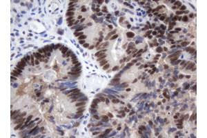 Image no. 2 for anti-Methyltransferase Like 16 (METTL16) antibody (ABIN1499432)