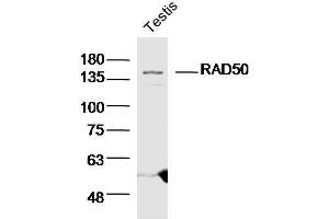 Mouse testis lysates probed with RAD50 Polyclonal Antibody  at 1:300 overnight at 4°C followed by a conjugated secondary antibody for 60 minutes at 37°C. (RAD50 anticorps  (AA 817-872))