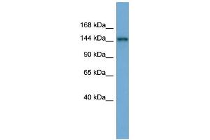 WB Suggested Anti-TEX14 Antibody Titration: 0. (TEX14 anticorps  (Middle Region))