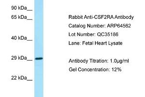 Western Blotting (WB) image for anti-Colony Stimulating Factor 2 Receptor, Alpha, Low-Affinity (Granulocyte-Macrophage) (CSF2RA) (N-Term) antibody (ABIN2789878) (CSF2RA anticorps  (N-Term))