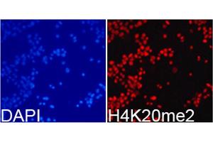 Immunofluorescence analysis of 293T cells using Dimethyl-Histone H4-K20 antibody (ABIN5969818). (Histone H4 anticorps  (2meLys20))