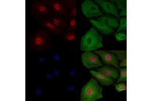 ABIN7093617 and ABIN7097642 staining  cells by IF/ICC. (MAPK8IP1 anticorps)