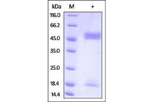 Mouse FcRn / FCGRT & B2M on SDS-PAGE under reducing (R) condition.