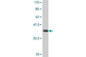 Western Blot detection against Immunogen (37 KDa) .