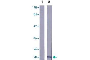 Western blot analysis of extracts from K-562 cells using MYL12A polyclonal antibody . (MYL12A anticorps  (Ser18))