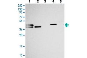Western blot analysis of Lane 1: RT-4, Lane 2: U-251 MG, Lane 3: Human Plasma, Lane 4: Liver, Lane 5: Tonsil with CHID1 polyclonal antibody . (CHID1 anticorps)