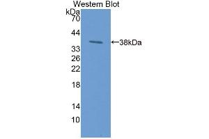 Western blot analysis of the recombinant protein. (LPO anticorps)