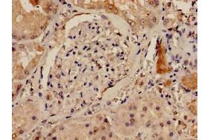 Immunohistochemistry analysis of human kidney tissue using ABIN7150068 at dilution of 1:100