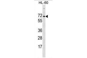 ACPL2 Antibody (Center) western blot analysis in HL-60 cell line lysates (35 µg/lane). (ACPL2 anticorps  (Middle Region))