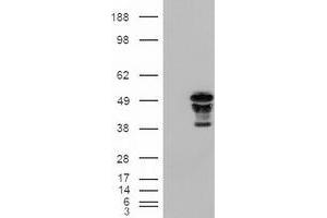 Western Blotting (WB) image for anti-Forkhead Box A2 (FOXA2) (AA 300-458) antibody (ABIN1491367) (FOXA2 anticorps  (AA 300-458))