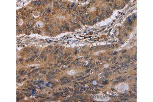 Immunohistochemistry of Human brain  using EIF3H Polyclonal Antibody at dilution of 1:40 (EIF3H anticorps)