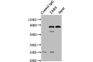 TARS anticorps  (AA 1-230)