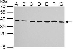 WB Image JAM-B antibody detects JAM2 protein by Western blot analysis. (JAM2 anticorps)