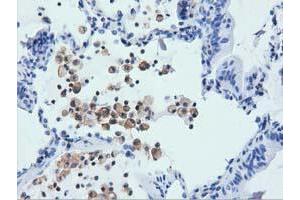 Immunohistochemistry (IHC) image for anti-rho GTPase Activating Protein 25 (ARHGAP25) antibody (ABIN1496701) (ARHGAP25 anticorps)