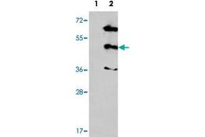 Western blot analysis of MAPK12 (arrow) using MAPK12 polyclonal antibody . (MAPK12 anticorps  (Internal Region))