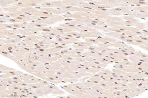 Immunohistochemistry analysis of paraffin-embedded rat heart using,ZBTB20 (ABIN7076248) at dilution of 1: 12000