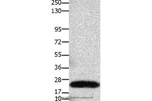 Western blot analysis of Human colon cancer tissue, using CLDN3 Polyclonal Antibody at dilution of 1:550