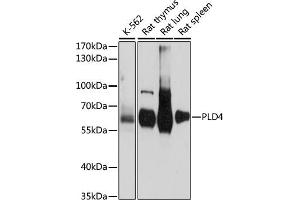 Western blot analysis of extracts of various cell lines, using PLD4 antibody (ABIN7269353) at 1:1000 dilution. (Phospholipase D4 anticorps  (AA 52-200))