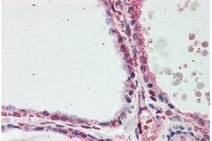 Human Thyroid: Formalin-Fixed, Paraffin-Embedded (FFPE)