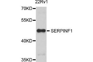 Western blot analysis of extract of 22Rv1 cells, using SERPINF1 antibody. (PEDF anticorps)