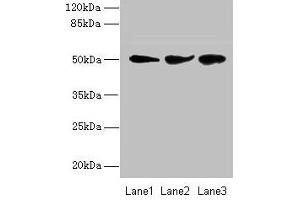 Western blot All lanes: NIM1K antibody at 2 μg/mL Lane 1: Jurkat whole cell lysate Lane 2: HepG2 whole cell lysate Lane 3: COLO205 whole cell lysate Secondary Goat polyclonal to rabbit IgG at 1/10000 dilution Predicted band size: 50 kDa Observed band size: 50 kDa (NIM1 anticorps  (AA 1-436))