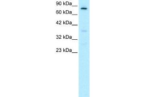 WB Suggested Anti-FOXE3 Antibody Titration:  0. (FOXE3 anticorps  (C-Term))