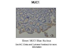 Sample Type :  Human stomach  Primary Antibody Dilution :  1:500  Secondary Antibody :  Anti-rabbit-HRP  Secondary Antibody Dilution :  1:1000  Color/Signal Descriptions :  Brown: MUC1 Blue: Nucleus  Gene Name :  MUC1  Submitted by :  Dr. (MUC1 anticorps  (C-Term))
