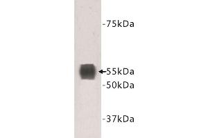 Western Blotting (WB) image for anti-Transmembrane Protein 132A (TMEM132A) antibody (ABIN1854988) (TMEM132A anticorps)