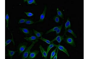 Immunofluorescent analysis of Hela cells using ABIN7143637 at dilution of 1:100 and Alexa Fluor 488-congugated AffiniPure Goat Anti-Rabbit IgG(H+L)