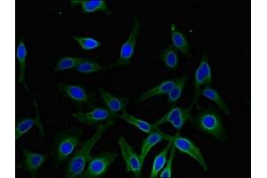 Immunofluorescent analysis of Hela cells using ABIN7143637 at dilution of 1:100 and Alexa Fluor 488-congugated AffiniPure Goat Anti-Rabbit IgG(H+L) (AKR1A1 anticorps  (AA 2-325))