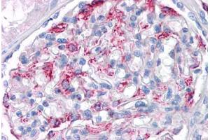 anti-Matrilin 1, Cartilage Matrix Protein (MATN1) (N-Term) antibody