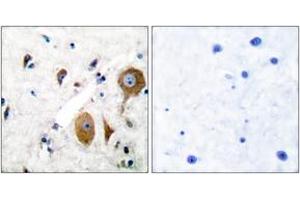 Immunohistochemistry analysis of paraffin-embedded human brain tissue, using mGluR8 Antibody.