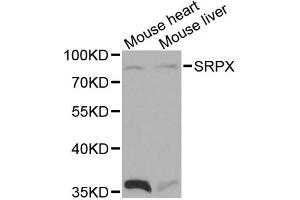 Western blot analysis of extracts of various cell lines, using SRPX antibody. (SRPX anticorps)