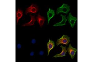 ABIN7094249 and ABIN7098296 staining HepG2 cells by IF/ICC. (GAMT anticorps  (Internal Region))