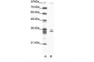 Image no. 1 for anti-PBX/knotted 1 Homeobox 2 (PKNOX2) (N-Term) antibody (ABIN202209) (PKNOX2 anticorps  (N-Term))