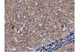 Immunohistochemical staining of paraffin-embedded Human liver tissue using anti-ACOT12 mouse monoclonal antibody. (ACOT12 anticorps)