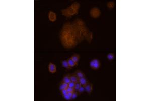 Immunofluorescence analysis of MCF7 cells using SOCS1 Rabbit mAb (ABIN7270640) at dilution of 1:100 (40x lens). (SOCS1 anticorps)