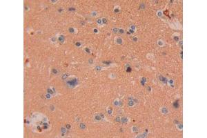 Used in DAB staining on fromalin fixed paraffin- embedded Kidney tissue