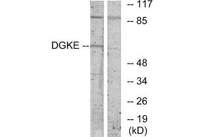 Western Blotting (WB) image for anti-Diacylglycerol Kinase, epsilon 64kDa (DGKE) (Internal Region) antibody (ABIN1849432) (DGKE anticorps  (Internal Region))